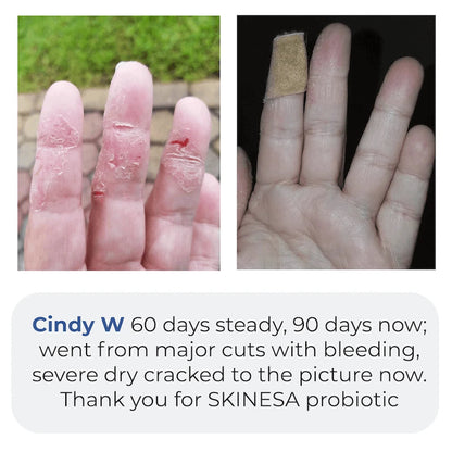 Skinesa customer testimonial